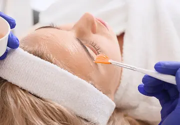 Woman receiving chemical peel