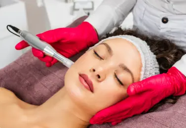 Woman receiving chemical peel