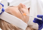 Woman receiving chemical peel